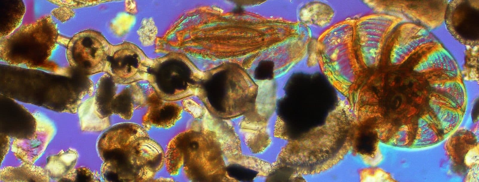 A collection of various foraminifera under a microscope. Their shapes mostly resemble seashells.