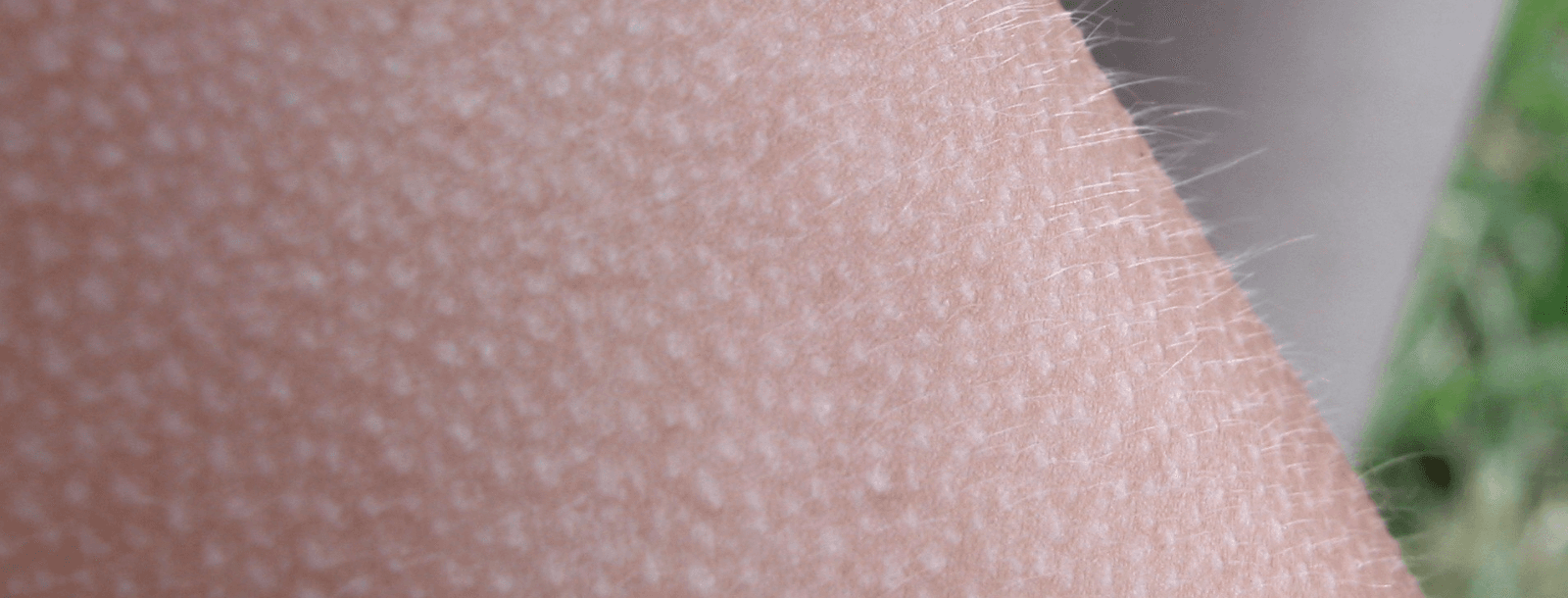 Close-up of a person's arm with goose bumps.